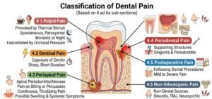 Classification of Dental Pain