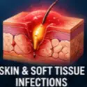Co Amoxiclave for Skin & Soft Tissue Infections