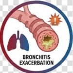 Moxifloxacin Life-Saving Antibiotic
