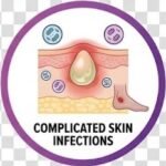 Moxifloxacin Life-Saving Antibiotic