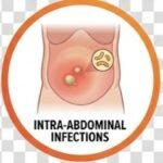 Moxifloxacin Life-Saving Antibiotic