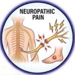 What Is Pain