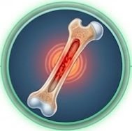 What Is Cephalexin Used For
