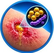 What Is Cefradine Used For