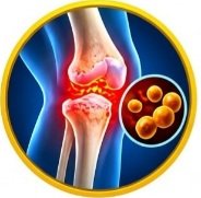 What Is Cefradine Used For