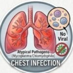 What Is Erythromycin Commonly Used For