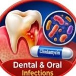 What Is Clindamycin Mainly Used For