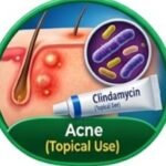 Clindamycin