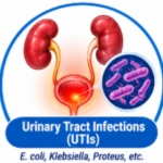 What Is Co-Trimoxazole Used For