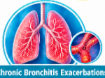 Cefuroxime Uses