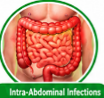 Ceftriaxone Sulbactam for Infection