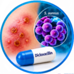 Dicloxacillin Uses and Side Effects