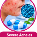 Tetracycline Uses