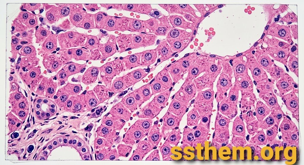 What Is Diagnosis