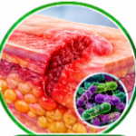 Amikacin Uses and Dosage