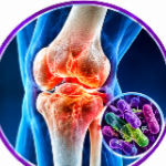 Amikacin Uses and Dosage