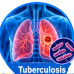 Streptomycin Uses