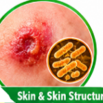Streptomycin injection uses, Streptomycin uses and side effects, Streptomycin dosage, Streptomycin 1g injection