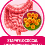 Vancomycin for MRSA, Vancomycin antibiotic, Vancomycin uses, Vancomycin dosing, Vancomycin side effects, Vancomycin mechanism of action