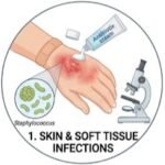 Teicoplanin 12 Life-Saving Facts, Teicoplanin uses and side effects, What is teicoplanin used for, Teicoplanin injection uses, Teicoplanin dosage, Teicoplanin 400 mg uses, Teicoplanin antibiotic, Teicoplanin side effects, What infections does teicoplanin treat, How does teicoplanin work against bacterial infections, Teicoplanin 400 mg dosage for adults, Glycopeptide antibiotic, MRSA treatment, Antibiotic resistance, Clinical pharmacology, Medical students