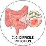 Teicoplanin 12 Life-Saving Facts, Teicoplanin uses and side effects, What is teicoplanin used for, Teicoplanin injection uses, Teicoplanin dosage, Teicoplanin 400 mg uses, Teicoplanin antibiotic, Teicoplanin side effects, What infections does teicoplanin treat, How does teicoplanin work against bacterial infections, Teicoplanin 400 mg dosage for adults, Glycopeptide antibiotic, MRSA treatment, Antibiotic resistance, Clinical pharmacology, Medical students