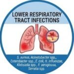 The Imipenem + Cilastatin Story,
Imipenem Cilastatin, Imipenem Cilastatin Injection, Imipenem Cilastatin Uses, Imipenem Cilastatin Side Effects, Imipenem Cilastatin Dosage, Imipenem Cilastatin Mechanism of Action, 