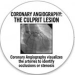 Heart Attack vs Cardiac Arrest, Heart Attack, Cardiac Arrest, Heart Attack Symptoms, Cardiac Arrest Symptoms, Heart Attack Warning Signs, Cardiac Arrest Causes, Heart Attack Differences, Cardiac Emergency, Heart Attack First Aid, Cardiac Arrest CPR, CPR, AED, Heart Attack Diagnosis, Cardiac Arrest Diagnosis, Cardiovascular Health