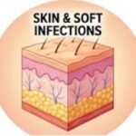 Dosage Secret Behind Cefoperazone + Sulbactam's, cefoperazone sulbactam injection, cefoperazone sulbactam uses, cefoperazone sulbactam dosage, cefoperazone sulbactam side effects, cefoperazone sulbactam 1g, cefoperazone sulbactam 2g, cefoperazone sulbactam injection uses, cefoperazone sulbactam antibiotic, cefoperazone and sulbactam injection,