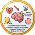 stroke diagnosis, stroke symptoms, stroke tests, stroke diagnosis criteria, how doctors diagnose stroke, stroke emergency tests, stroke blood test, stroke CT scan, stroke MRI, FAST stroke test, ischemic stroke diagnosis