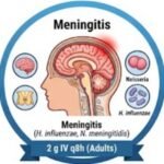 Miracle Drug or Risky Business Ceftazidime, Miracle Drug, Risky Business, Antibiotic Resistance, Superbug Killer, Ceftazidime Avibactam, Pseudomonas Aeruginosa, Cystic Fibrosis Treatment