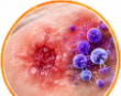 cefazolin, cefazolin exposed, cefazolin injection, cefazolin uses, cefazolin dosage, cefazolin side effects, cefazolin for surgery, cefazolin surgical prophylaxis, cefazolin antibiotic,