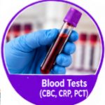 Diagnose Pneumonia, silent pneumonia, walking pneumonia, pneumonia symptoms, chest x-ray pneumonia, pneumonia diagnose test, pneumonia treatment, pneumonia recovery, pneumonia in elderly, pneumonia in kids, atypical pneumonia, viral pneumonia, bacterial pneumonia, pneumonia warning signs, early pneumonia detection, pneumonia misdiagnosis, pneumonia diagnose at home, pneumonia antibiotics