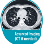 Diagnose Pneumonia, silent pneumonia, walking pneumonia, pneumonia symptoms, chest x-ray pneumonia, pneumonia diagnose test, pneumonia treatment, pneumonia recovery, pneumonia in elderly, pneumonia in kids, atypical pneumonia, viral pneumonia, bacterial pneumonia, pneumonia warning signs, early pneumonia detection, pneumonia misdiagnosis, pneumonia diagnose at home, pneumonia antibiotics