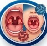 Cefprozil and Vaginal Discomfort, Cefprozil side effects, Cefprozil vaginal itching, Cefprozil yeast infection, Cefprozil antibiotic vaginal, Cefprozil genital itching, Cefprozil vaginal discharge, Cefprozil candidiasis, Cefprozil itching, Cefprozil vaginitis, Cefprozil genital pruritus, Does Cefprozil cause vaginal itching, Cefprozil side effects vaginal itching and discharge,