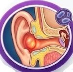 Cefprozil and Vaginal Discomfort, Cefprozil side effects, Cefprozil vaginal itching, Cefprozil yeast infection, Cefprozil antibiotic vaginal, Cefprozil genital itching, Cefprozil vaginal discharge, Cefprozil candidiasis, Cefprozil itching, Cefprozil vaginitis, Cefprozil genital pruritus, Does Cefprozil cause vaginal itching, Cefprozil side effects vaginal itching and discharge,