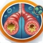 Cefprozil and Vaginal Discomfort, Cefprozil side effects, Cefprozil vaginal itching, Cefprozil yeast infection, Cefprozil antibiotic vaginal, Cefprozil genital itching, Cefprozil vaginal discharge, Cefprozil candidiasis, Cefprozil itching, Cefprozil vaginitis, Cefprozil genital pruritus, Does Cefprozil cause vaginal itching, Cefprozil side effects vaginal itching and discharge,